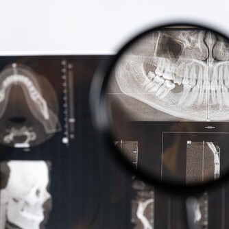 diagnostyka obrazowa zebow w Bielany Dental, tomograf